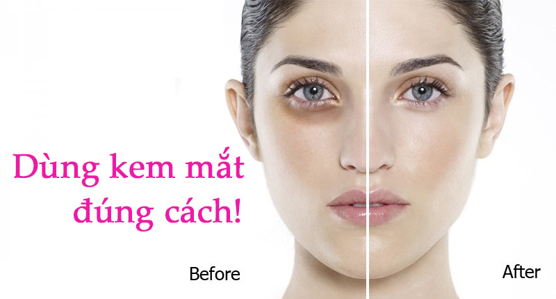 Bạn có biết dùng kem mắt sao cho đúng chưa?