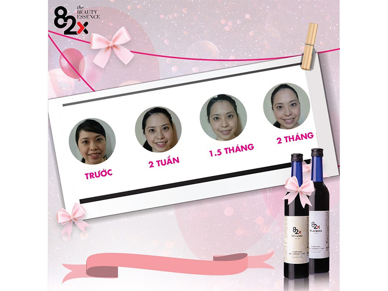 Sử dụng 82x Beauty bao lâu thì có hiệu quả? 