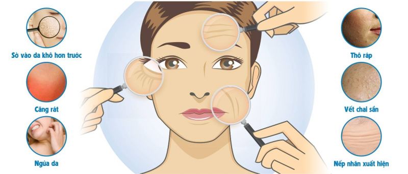 Cách chọn sữa rửa mặt để chăm sóc nàng da khô