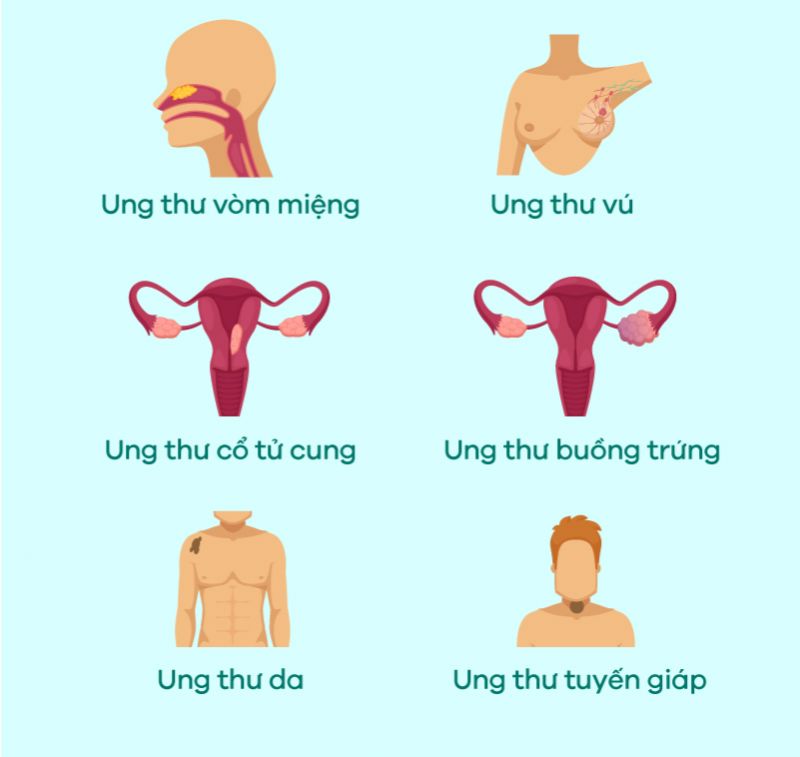 [Infographic] Hiểu biết về Ung thư và cách phòng ngừa hiệu quả