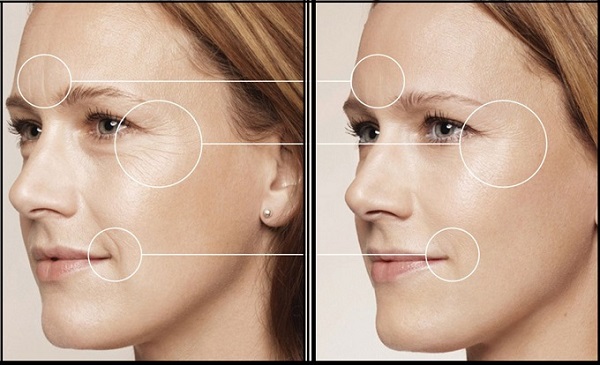 Collagen dạng viên hãng nào là tốt nhất? Tại sao nên uống Collagen