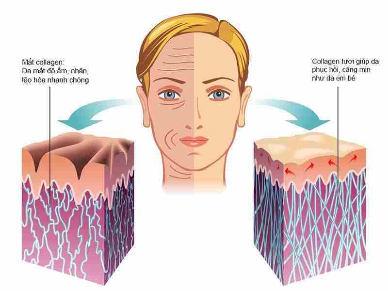Lí do nên bổ sung collagen cho cơ thể