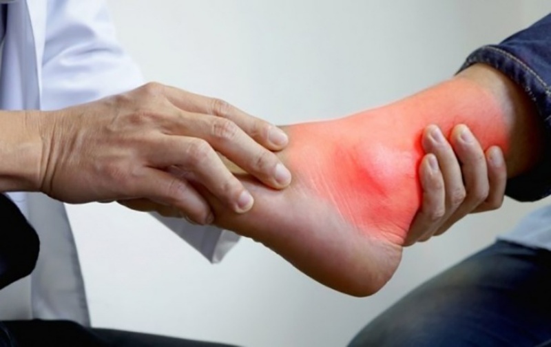 Bệnh gout
