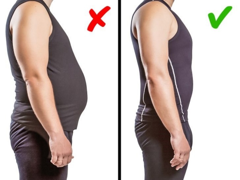 Giảm cân để giảm đau cổ vai gáy