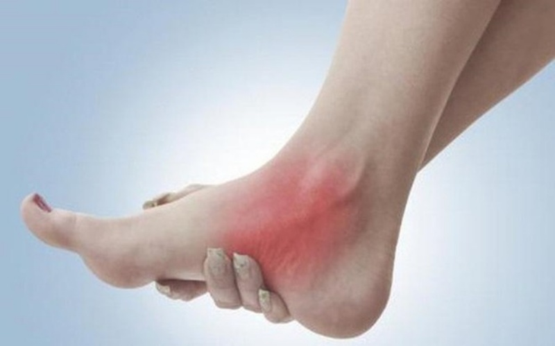 Bong gân thường xảy ra tại các vùng cổ chân, cổ tay, ngón tay,.. do va đập mạnh