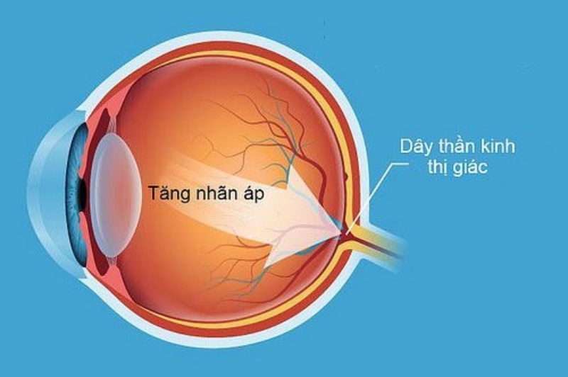 diem-danh-mot-so-benh-ve-mat-thuong-gap