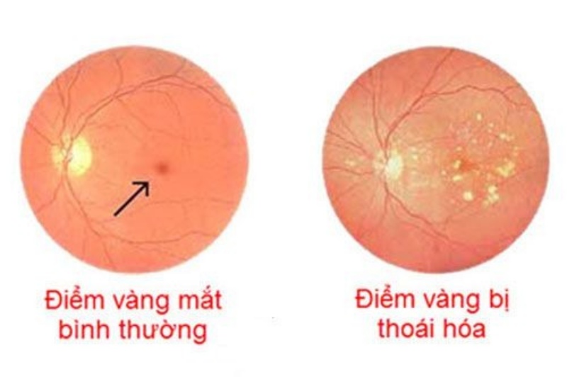 diem-danh-mot-so-benh-ve-mat-thuong-gap