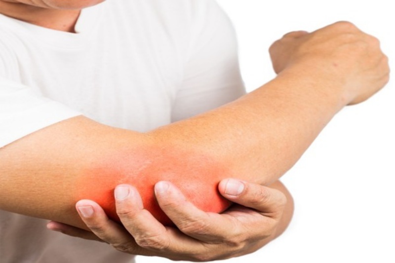 Chấn thương mỏm khuỷu dễ bị do va chạm mạnh khi tham gia giao thông