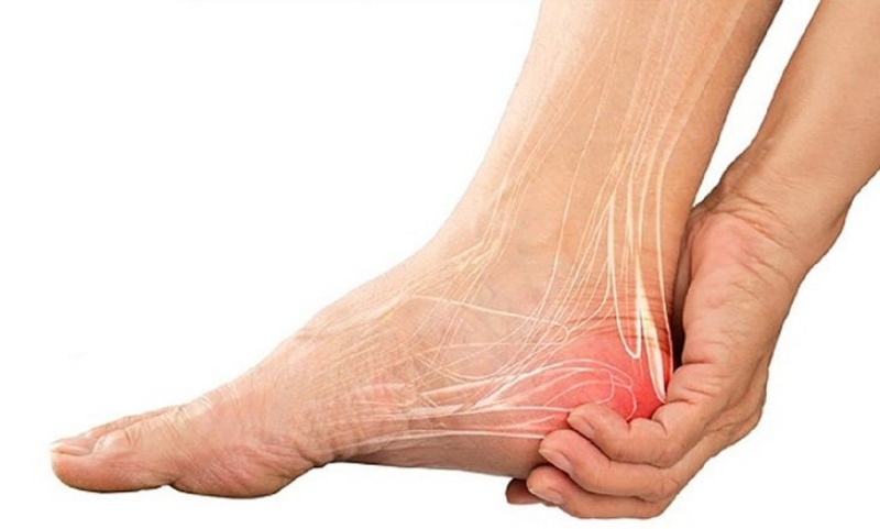 Đau gót chân là biểu hiện bệnh gì?