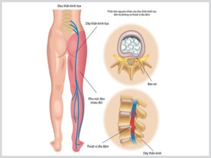 Dấu hiệu nhận biết bệnh.