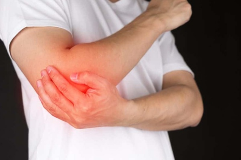 Gãy chỏm tay là tổn thương thường gặp nhất ở vùng khuỷu tay