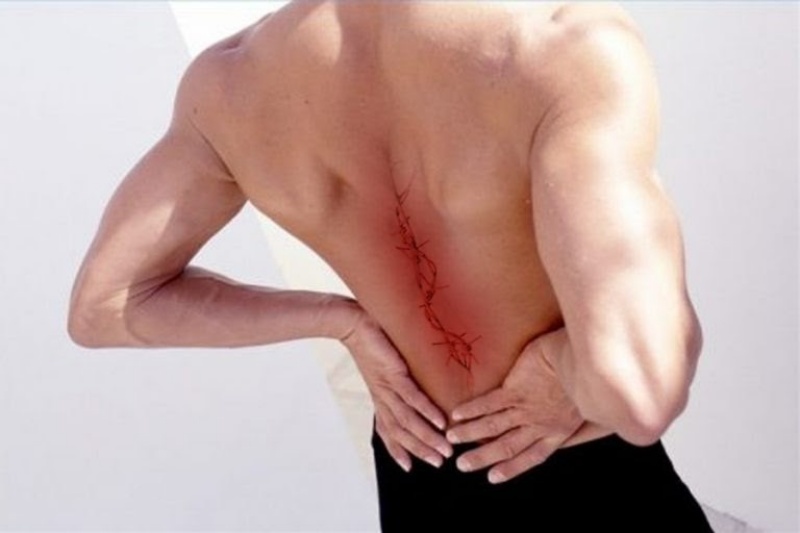 Các biện pháp chẩn đoán bệnh Gai cột sống