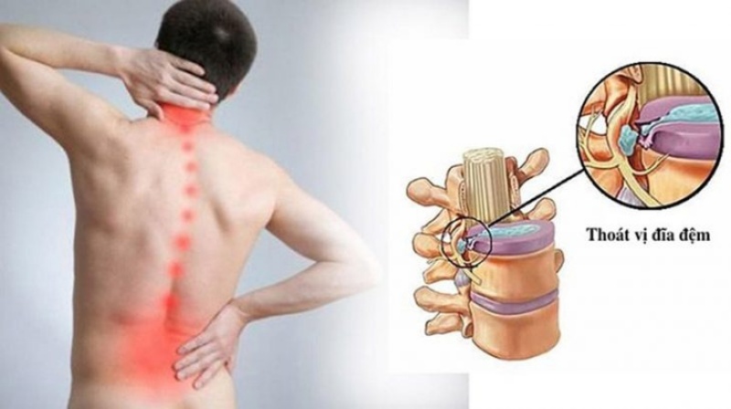 Dùng thuốc giảm đau, kháng viêm