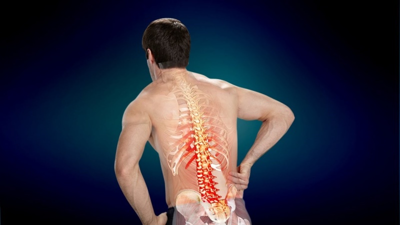 Thoái hóa cột sống