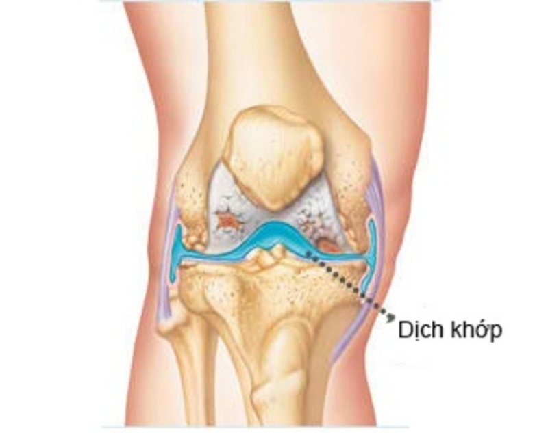 Khớp xương kêu khi cử động do thiếu dịch khớp