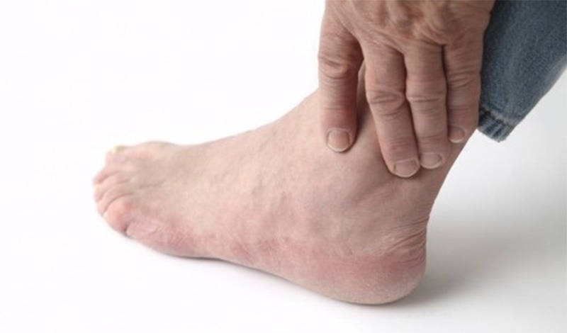 Đau khớp cổ chân là một trong những dạng bệnh lý liên quan đến xương khớp.