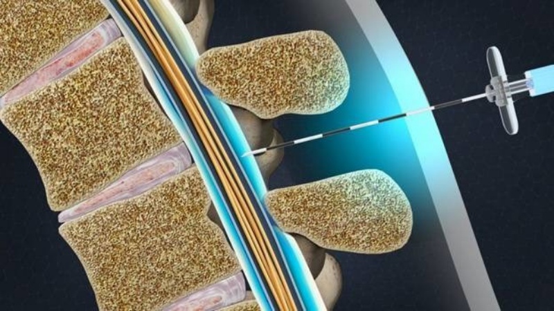Phải có chỉ định của bác sĩ và tiêm “phải đúng chỗ”