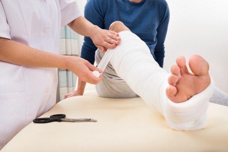 Gãy xương mác bao lâu tập đi được?