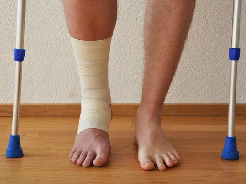 Người bệnh cần chú ý luyện tập sau gãy để nhanh hồi phục
