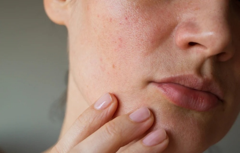 Các tình trạng dị ứng có thể gây mẩn ngứa