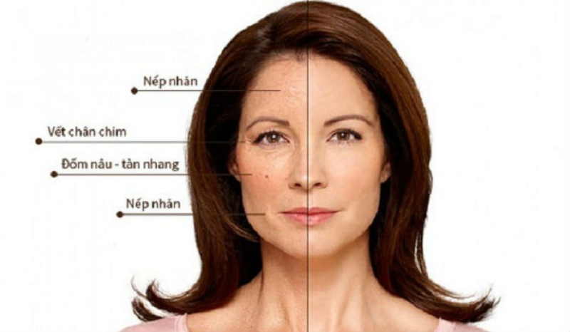 Vì sao phụ nữ trung niên bị lão hóa da?