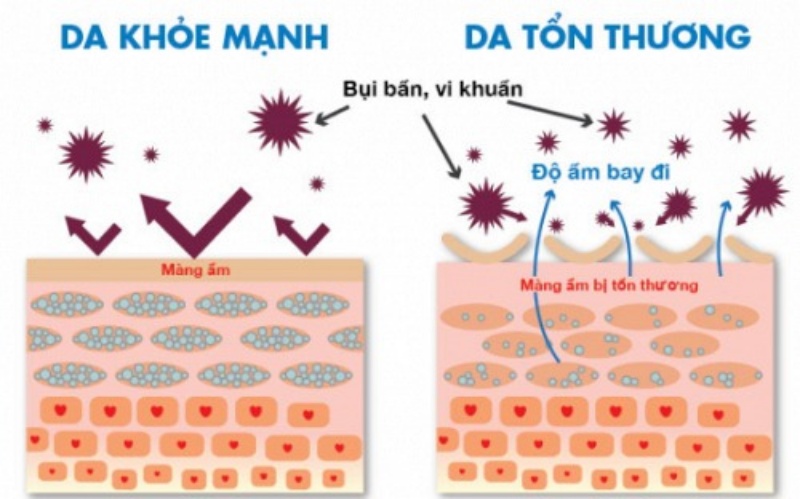 Tầm quan trọng của hàng rào bảo vệ da