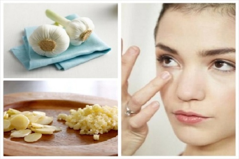 Sử dụng tỏi nguyên chất để điều trị đồi mồi