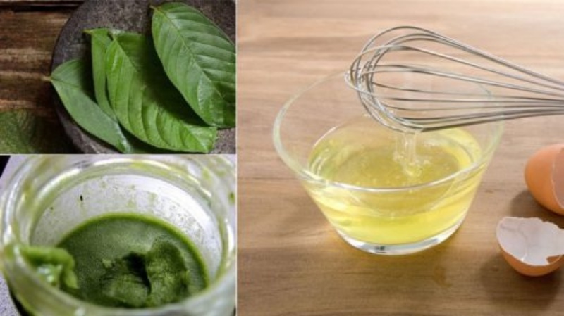 Tẩy sạch thâm nám với mặt nạ lá ổi và trứng gà