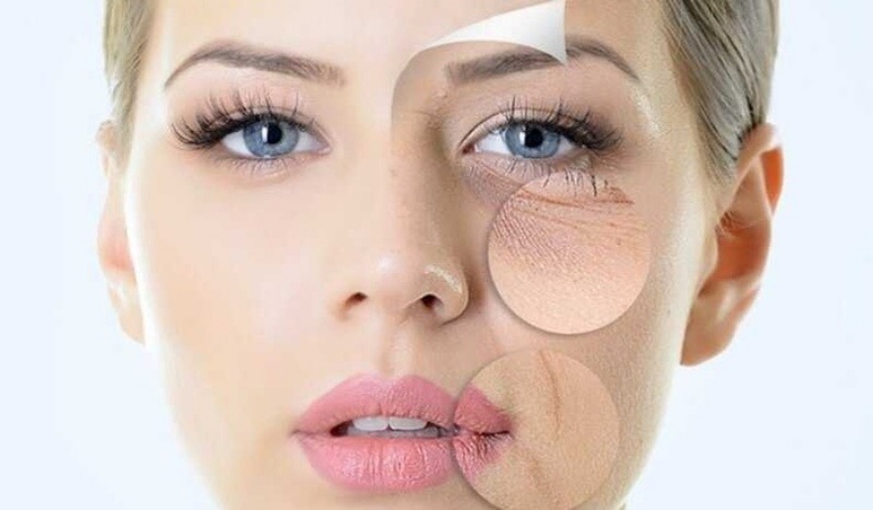 Mặt sẽ bị lên mụn