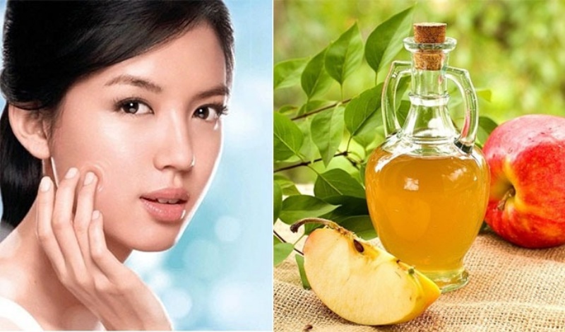 Cải thiện mụn sưng viêm tại nhà với giấm táo
