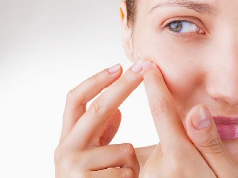 Se khít lỗ chân lông sau nặn mụn có quan trọng không?
