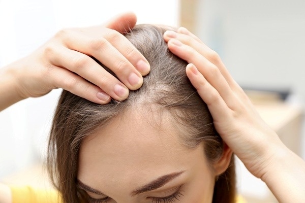 Vì sao bước qua 40 tuổi hay bị rụng tóc?