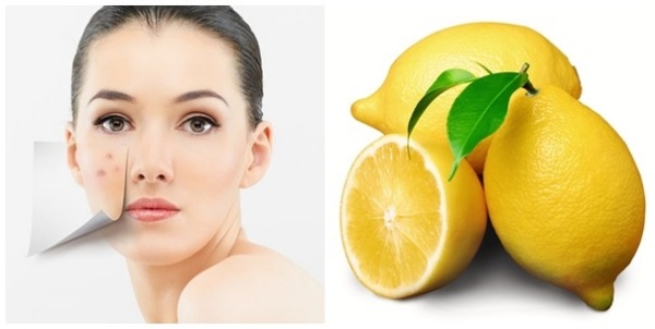 Trị sẹo thâm với chanh