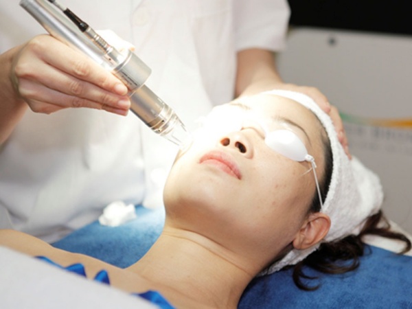 Phương pháp trị sẹo thâm lâu năm bằng tia laser