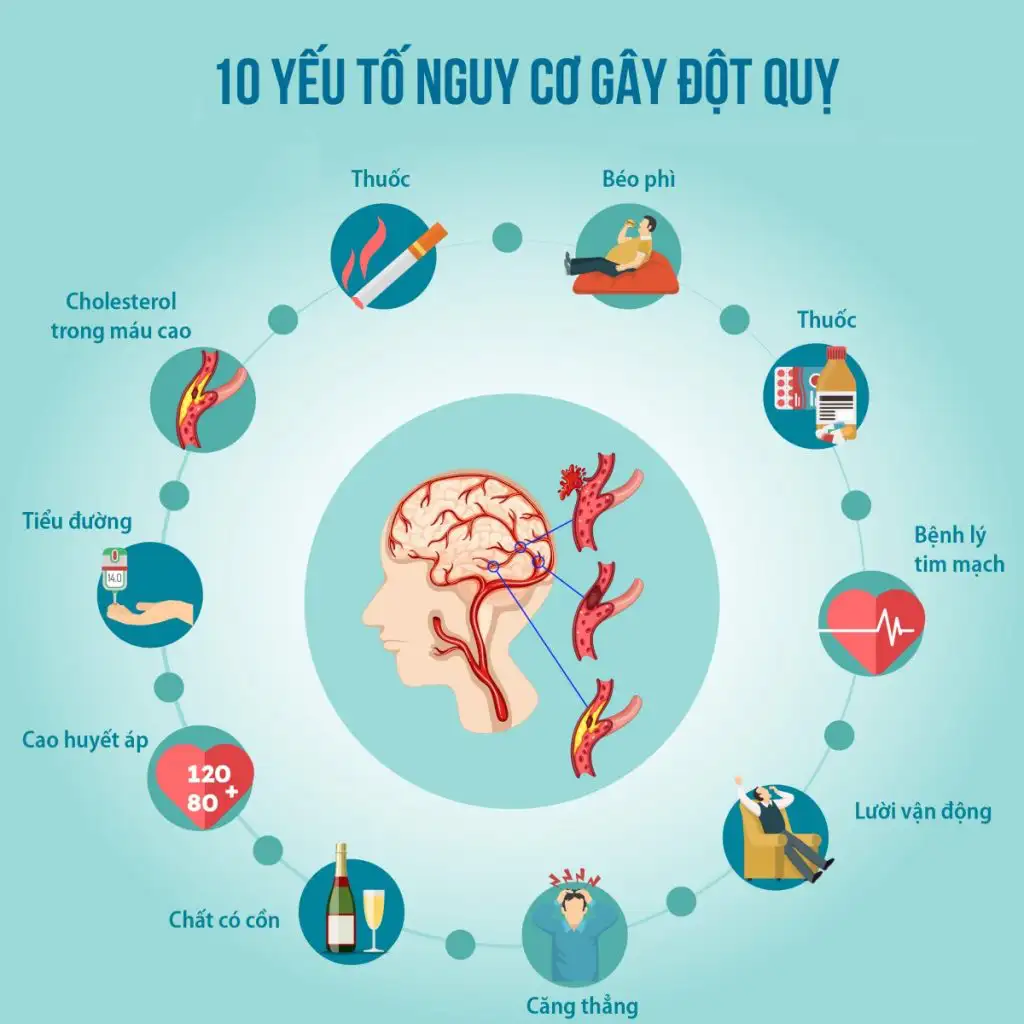 nhung-yeu-to-nguy-co-gay-dot-quy