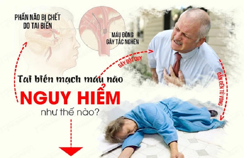 Ăn gì để phòng ngừa giảm tai biến mạch máu não