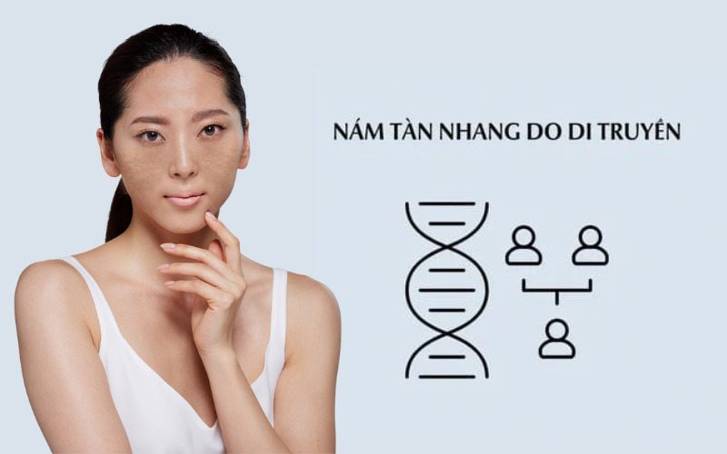 Nguyên nhân gây nám da ở phụ nữ