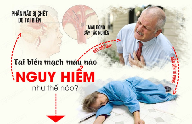 Thuốc phòng ngừa tai biến mạch máu não của Nhật
