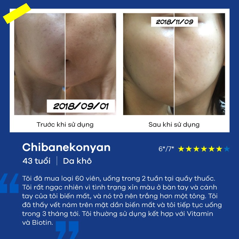 Top Sản Phẩm Trị Nám Nhật Bản Được Chị Em Tin Dùng N.h.ấ.t Hiện Nay