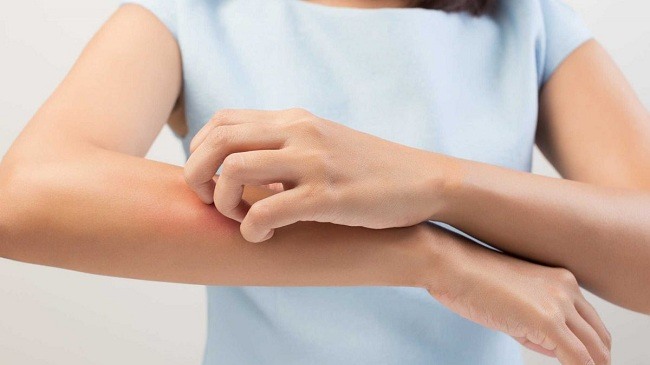 Việc sử dụng đông trùng hạ thảo không đúng cách có thể dẫn đến kích ứng da