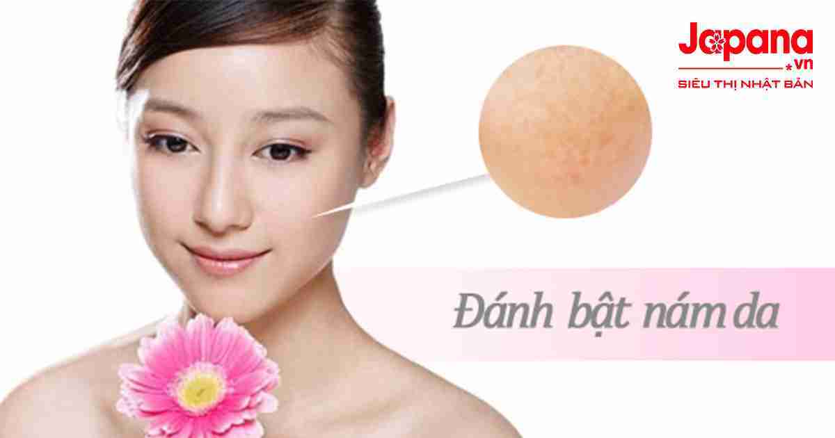 Top 5 sản phẩm trị nám Nhật Bản đáng mua nhất hiện nay