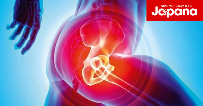 Các triệu chứng đau khớp háng theo từng giai đoạn có thể bạn chưa biết