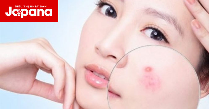 Uống collagen thế nào để không bị nóng?