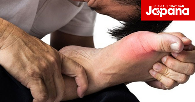Nguyên nhân gây ra bệnh Gout và hướng phòng, điều trị hiệu quả nhất