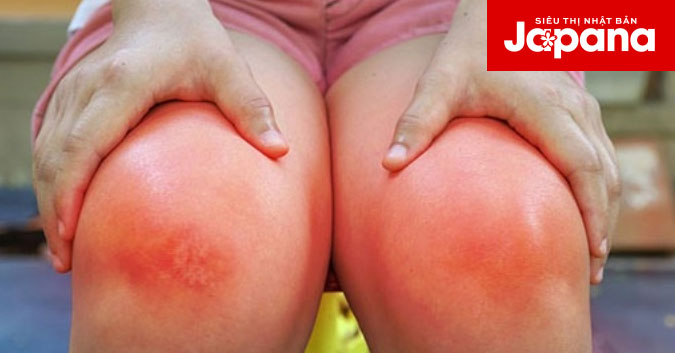 Nguyên nhân và cách điều trị bệnh viêm khớp dạng thấp