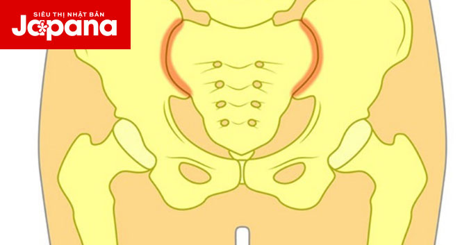 Tìm hiểu nguyên nhân và cách điều trị bệnh viêm khớp vùng chậu