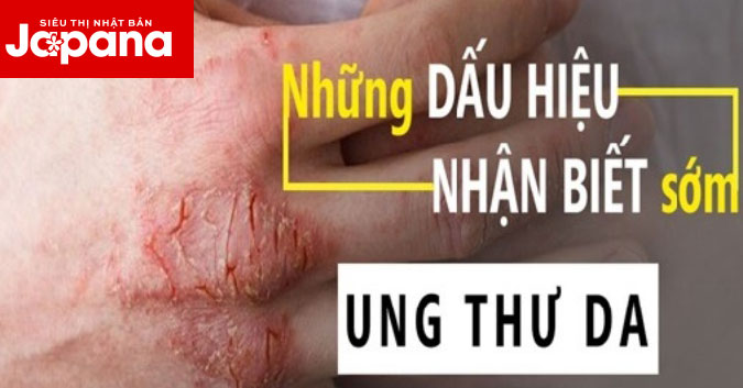 Những dấu hiệu nhận biết sớm của bệnh ung thư da