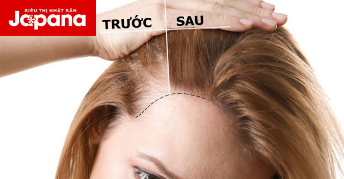 Bật mí bí kíp giúp trị rụng tóc từ trà xanh đơn giản mà cực kỳ hiệu quả