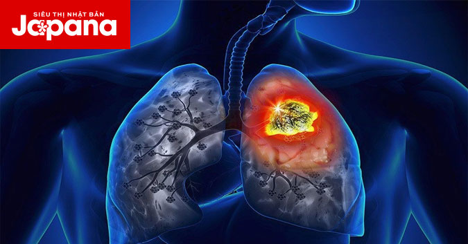 Ung thư phổi có nên ăn yến không? Những thông tin cần biết