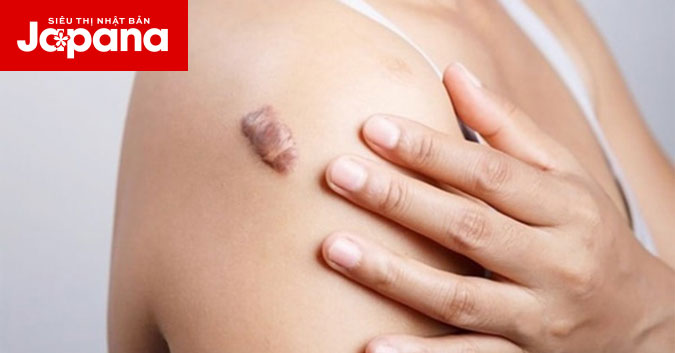 Một số thực phẩm giúp vết thương mau lành hơn
